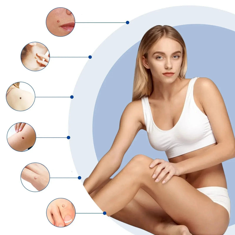 Kit pentru îndepărtarea negilor și a creșterii pielii